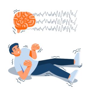Can PTSD Cause Seizures